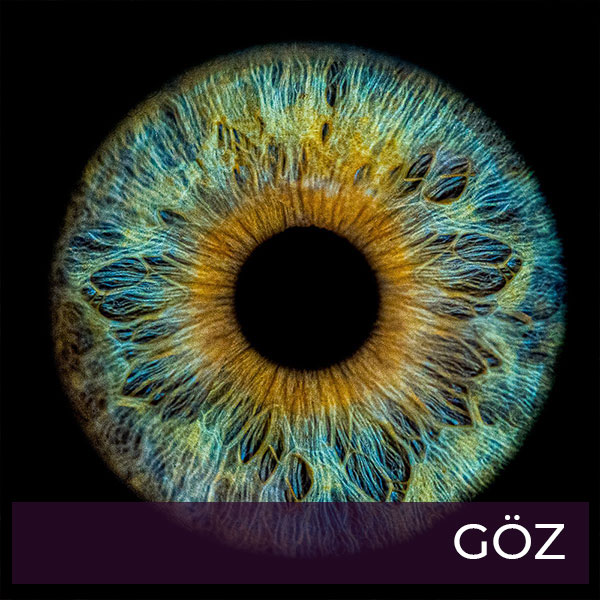 goz1